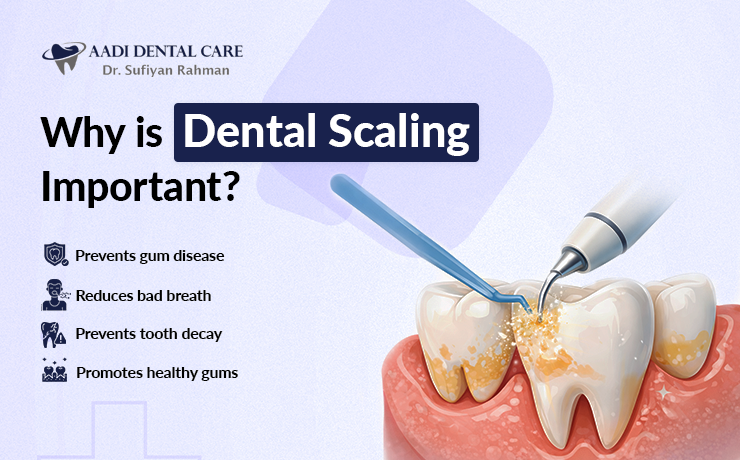 Why Dental Scaling is Important for Your Teeth